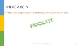 • When a small exposure can be treated shortly after injury within 24 hours..
INDICATION
DR.TINET MARY AUGUSTINE.BDS.MDS 100
 