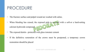 • The fracture surface and pulpal wound are washed with saline.
• When bleeding has ceased, the exposed pulp is covered with a soft-or a hard-setting
calcium hydroxide compound.
• The exposed dentin - protected with glass ionomer cement
• If the definitive restoration of the crown must be postponed, a temporary crown
restoration should be placed
PROCEDURE
DR.TINET MARY AUGUSTINE.BDS.MDS 101
 