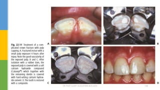 DR.TINET MARY AUGUSTINE.BDS.MDS 108
 