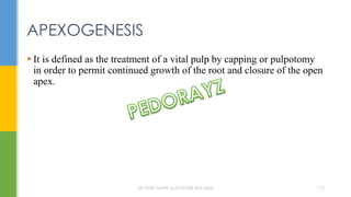  It is defined as the treatment of a vital pulp by capping or pulpotomy
in order to permit continued growth of the root and closure of the open
apex.
APEXOGENESIS
DR.TINET MARY AUGUSTINE.BDS.MDS 113
 