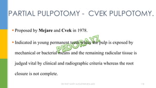  Proposed by Mejare and Cvek in 1978.
 Indicated in young permanent teeth where the pulp is exposed by
mechanical or bacterial means and the remaining radicular tissue is
judged vital by clinical and radiographic criteria whereas the root
closure is not complete.
PARTIAL PULPOTOMY - CVEK PULPOTOMY.
DR.TINET MARY AUGUSTINE.BDS.MDS 118
 