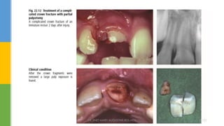 DR.TINET MARY AUGUSTINE.BDS.MDS 121
 