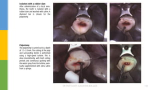 DR.TINET MARY AUGUSTINE.BDS.MDS 122
 