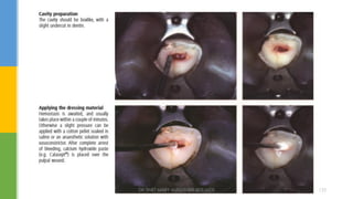 DR.TINET MARY AUGUSTINE.BDS.MDS 123
 