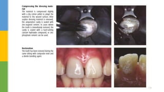 DR.TINET MARY AUGUSTINE.BDS.MDS 124
 