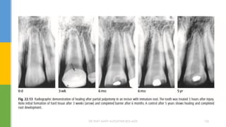 DR.TINET MARY AUGUSTINE.BDS.MDS 126
 