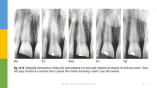 DR.TINET MARY AUGUSTINE.BDS.MDS 127
 