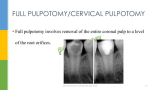  Full pulpotomy involves removal of the entire coronal pulp to a level
of the root orifices.
FULL PULPOTOMY/CERVICAL PULPOTOMY
DR.TINET MARY AUGUSTINE.BDS.MDS 131
 