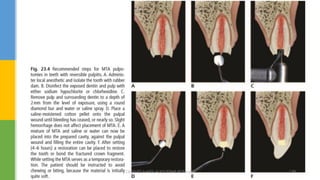 DR.TINET MARY AUGUSTINE.BDS.MDS 139
 