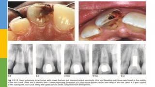 DR.TINET MARY AUGUSTINE.BDS.MDS 140
 