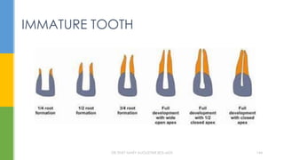 IMMATURE TOOTH
DR.TINET MARY AUGUSTINE.BDS.MDS 144
 