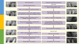 DR.TINET MARY AUGUSTINE.BDS.MDS 167
 