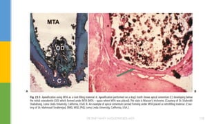 DR.TINET MARY AUGUSTINE.BDS.MDS 170
 