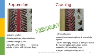 Separation Crushing
-extrusive luxation
-Cleavage of intercellular structures
-Limited damage to cells
-Wound healing by the existing
cellular system with minimum delay.
-Intrusive luxation
-extensive damage to cellular & intercellular
system
-wound healing by removal of damaged tissue
by macrophages & osteoclasts before
restoration of traumatized tissue
-delayed healing (splinting period)
DR.TINET MARY AUGUSTINE.BDS.MDS 18
 