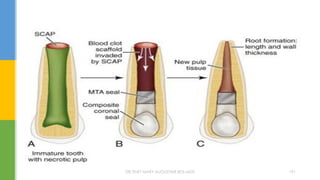 DR.TINET MARY AUGUSTINE.BDS.MDS 191
 