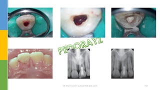 DR.TINET MARY AUGUSTINE.BDS.MDS 192
 