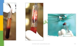 DR.TINET MARY AUGUSTINE.BDS.MDS 199
 