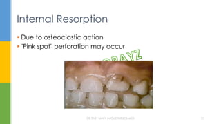 Internal Resorption
 Due to osteoclastic action
 "Pink spot" perforation may occur
DR.TINET MARY AUGUSTINE.BDS.MDS 21
 