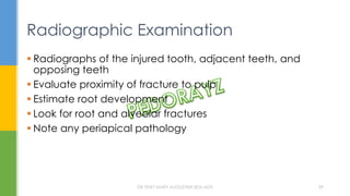 Radiographic Examination
 Radiographs of the injured tooth, adjacent teeth, and
opposing teeth
 Evaluate proximity of fracture to pulp
 Estimate root development
 Look for root and alveolar fractures
 Note any periapical pathology
DR.TINET MARY AUGUSTINE.BDS.MDS 29
 