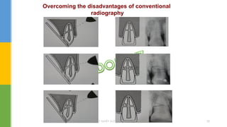 Overcoming the disadvantages of conventional
radiography
DR.TINET MARY AUGUSTINE.BDS.MDS 30
 