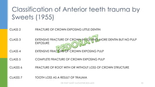 CLASS 1 FRACTURE OF CROWN EXPOSING NO DENTIN
CLASS 2 FRACTURE OF CROWN EXPOSING LITTLE DENTIN
CLASS 3 EXTENSIVE FRACTURE OF CROWN INVOLVING MORE DENTIN BUT NO PULP
EXPOSURE
CLASS 4 EXTENSIVE FRACTURE OF CROWN EXPOSING PULP
CLASS 5 COMPLETE FRACTURE OF CROWN EXPOSING PULP
CLASSS 6 FRACTURE OF ROOT WITH OR WITHOUT LOSS OF CROWN STRUCTURE
CLASSS 7 TOOTH LOSS AS A RESULT OF TRAUMA
Classification of Anterior teeth trauma by
Sweets (1955)
DR.TINET MARY AUGUSTINE.BDS.MDS 33
 