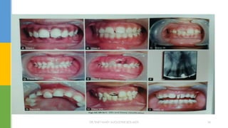 DR.TINET MARY AUGUSTINE.BDS.MDS 36
 