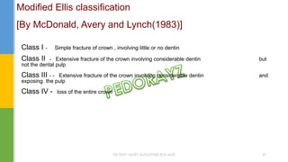 Modified Ellis classification
[By McDonald, Avery and Lynch(1983)]
Class I - Simple fracture of crown , involving little or no dentin
Class II - Extensive fracture of the crown involving considerable dentin but
not the dental pulp
Class III - - Extensive fracture of the crown involving considerable dentin and
exposing the pulp
Class IV - loss of the entire crown
DR.TINET MARY AUGUSTINE.BDS.MDS 37
 