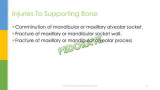 Injuries To Supporting Bone
 Comminution of mandibular or maxillary alveolar socket.
 Fracture of maxillary or mandibular socket wall.
 Fracture of maxillary or mandibular alveolar process
DR.TINET MARY AUGUSTINE.BDS.MDS 40
 