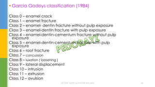  Garcia Godoys classification (1984)
Class 0 – enamel crack
Class 1 – enamel fracture
Class 2 – enamel- dentin fracture without pulp exposure
Class 3 – enamel-dentin fracture with pulp exposure
Class 4 – enamel-dentin-cementum fracture without pulp
exposure
Class 5 – enamel-dentin-cementum fracture with pulp
exposure
Class 6 – root fracture
Class 7 – concussion
Class 8 – luxation ( loosening )
Class 9 – lateral displacement
Class 10 – intrusion
Class 11 – extrusion
Class 12 – avulsion
DR.TINET MARY AUGUSTINE.BDS.MDS 43
 