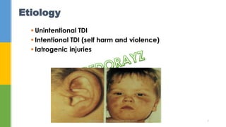 Etiology
 Unintentional TDI
 Intentional TDI (self harm and violence)
 Iatrogenic injuries
DR.TINET MARY AUGUSTINE.BDS.MDS 7
 