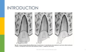 INTRODUCTION
DR.TINET MARY AUGUSTINE.BDS.MDS 71
 