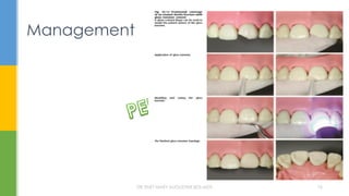 Management
DR.TINET MARY AUGUSTINE.BDS.MDS 76
 
