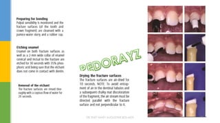 DR.TINET MARY AUGUSTINE.BDS.MDS 79
 