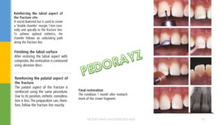 DR.TINET MARY AUGUSTINE.BDS.MDS 81
 