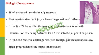 Biologic Consequences
• If left untreated - results in pulp necrosis.
• First reaction after the injury is hemorrhage and local inflammation .
• In the first 24 hours after the injury, a proliferative response with
inflammation extending not more than 2 mm into the pulp will be present
• In time, the bacterial challenge results in local pulpal necrosis and a slow
apical progression of the pulpal inflammation
DR.TINET MARY AUGUSTINE.BDS.MDS 88
 