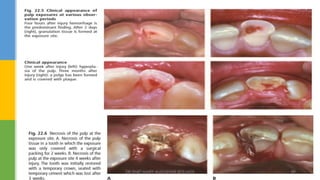 DR.TINET MARY AUGUSTINE.BDS.MDS 89
 