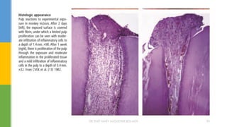 DR.TINET MARY AUGUSTINE.BDS.MDS 90
 