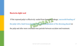 Bacteria-tight seal
If the exposed pulp is effectively sealed from bacterial leakage, successful healing of
the pulp with a hard tissue barrier will occur independent of the dressing placed on
the pulp and after more extended time periods between accident and treatment.
DR.TINET MARY AUGUSTINE.BDS.MDS 97
 