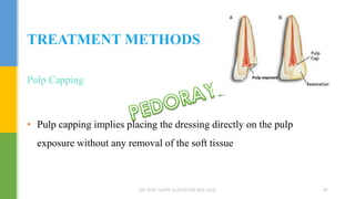 Pulp Capping
• Pulp capping implies placing the dressing directly on the pulp
exposure without any removal of the soft tissue
TREATMENT METHODS
DR.TINET MARY AUGUSTINE.BDS.MDS 99
 