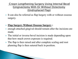 Crown lengthening | PPTX