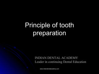 Principle of tooth
preparation
www.indiandentalacademy.comwww.indiandentalacademy.com
INDIAN DENTAL ACADEMY
Leader in continuing Dental Education
 