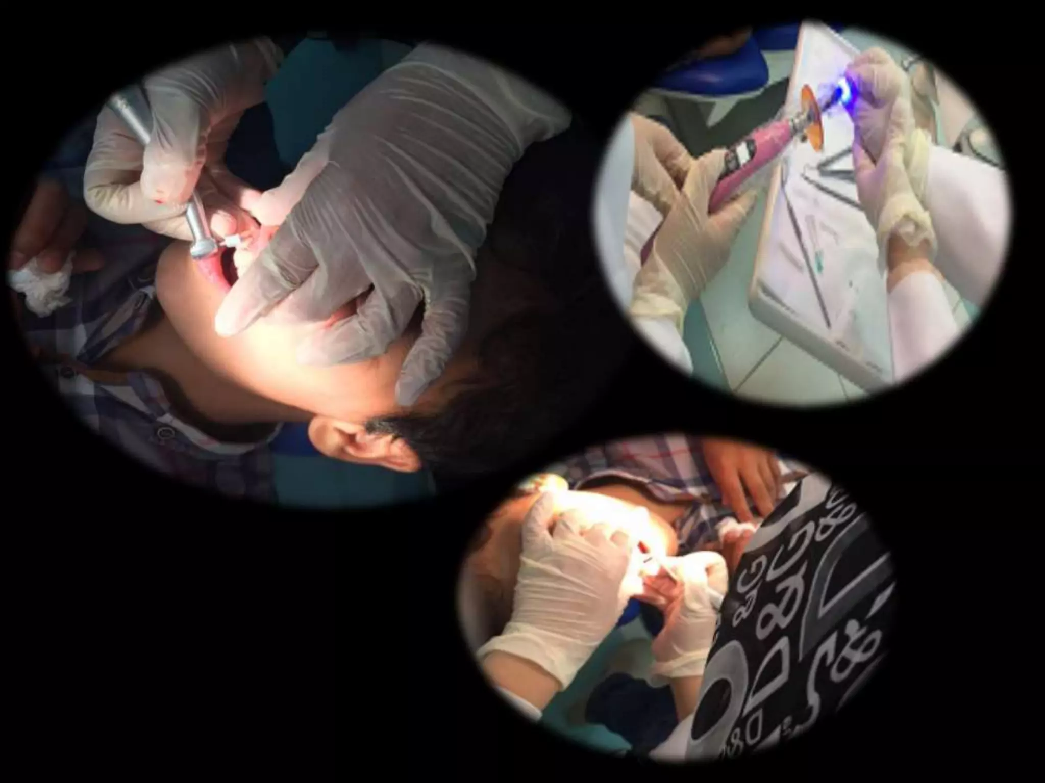 Crown reattachment PPT