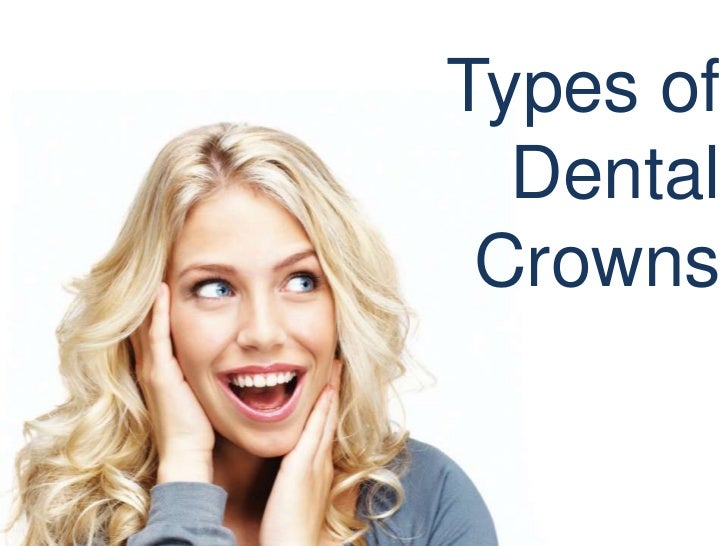 Types of Dental Crowns