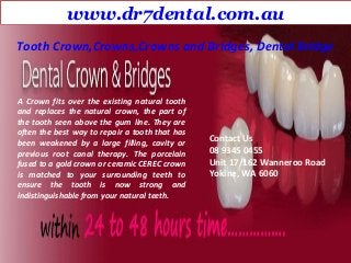 www.dr7dental.com.au
A Crown fits over the existing natural tooth
and replaces the natural crown, the part of
the tooth seen above the gum line. They are
often the best way to repair a tooth that has
been weakened by a large filling, cavity or
previous root canal therapy. The porcelain
fused to a gold crown or ceramic CEREC crown
is matched to your surrounding teeth to
ensure the tooth is now strong and
indistinguishable from your natural teeth.
Tooth Crown,Crowns,Crowns and Bridges, Dental Bridge
Contact Us
08 9345 0455
Unit 17/162 Wanneroo Road
Yokine, WA 6060
 