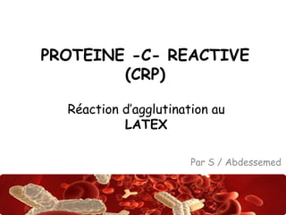 PROTEINE -C- REACTIVE 
Abdsalah 
(CRP) 
Réaction d’agglutination au 
LATEX 
Par S / Abdessemed 
 