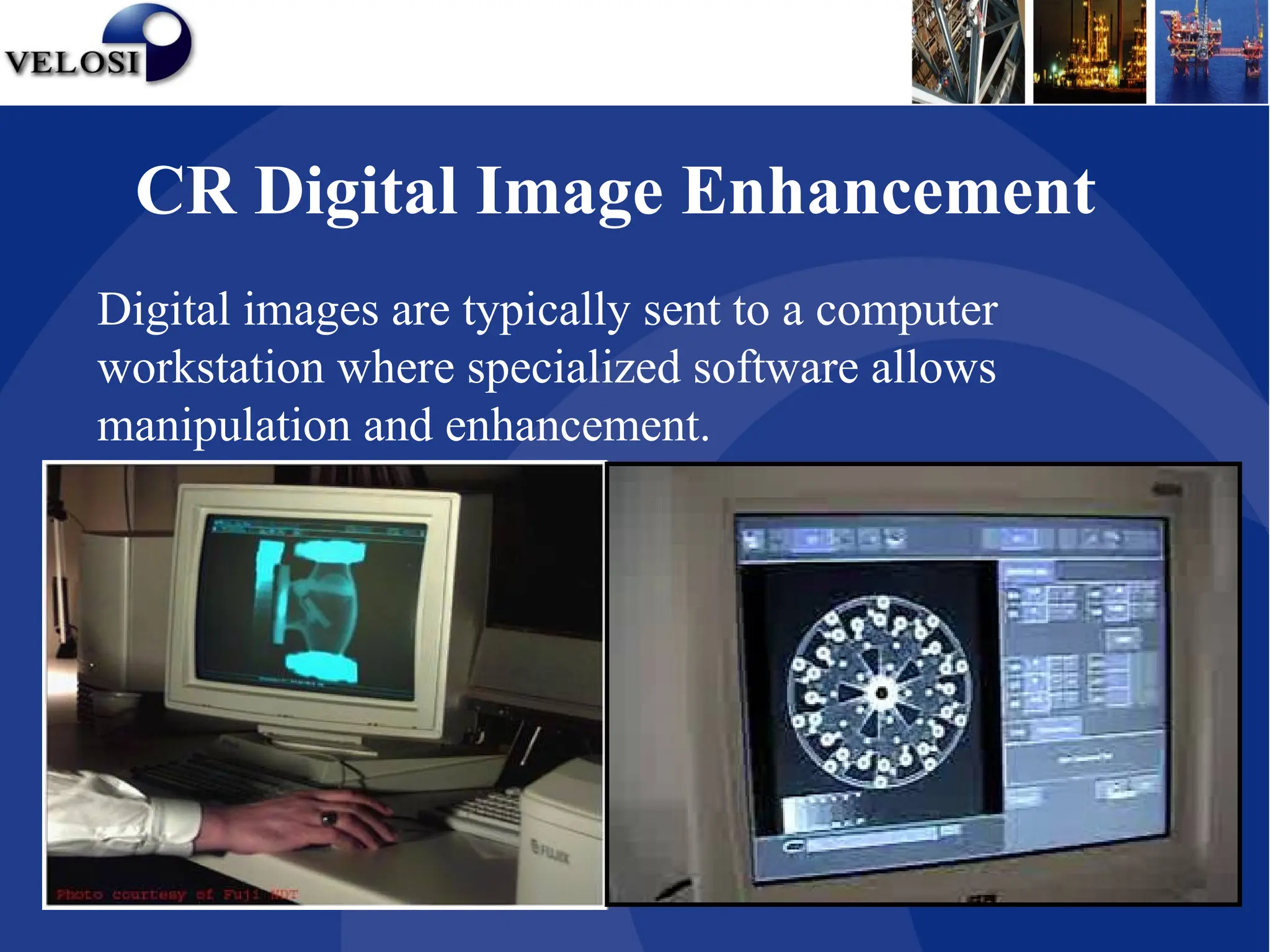 CR Digital Image Enhancement
Digital images are typically sent to a computer
workstation where specialized software allows
manipulation and enhancement.
 