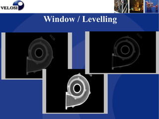 Window Level Radiology Button CR Presentation.ppt - Computed Radiography | PPT