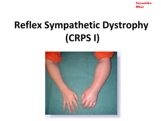 Sayantika
                         Dhar




Reflex Sympathetic Dystrophy
          (CRPS I)
 