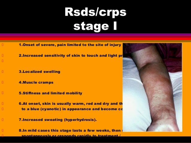 crps pictures
