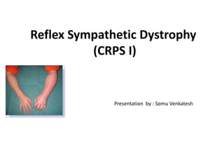 Reflex Sympathetic Dystrophy
(CRPS I)
Presentation by : Somu Venkatesh
 